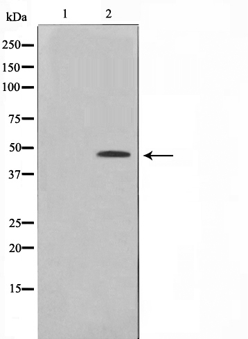 p-CtBP1 (S422) Ab