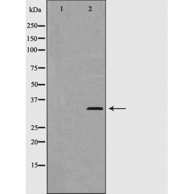 p-Cyclin D2 (T280) Ab