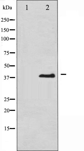 p-eIF2A (S51) Ab