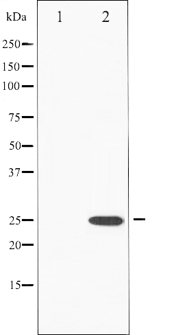 p-eIF4E (S209) Ab