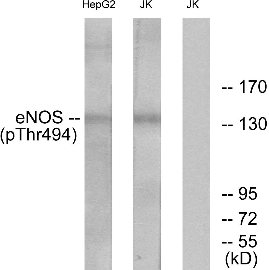 p-eNOS (T494) Ab