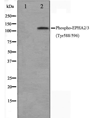 p-EPHA2/3 (Y588/Y596) Ab