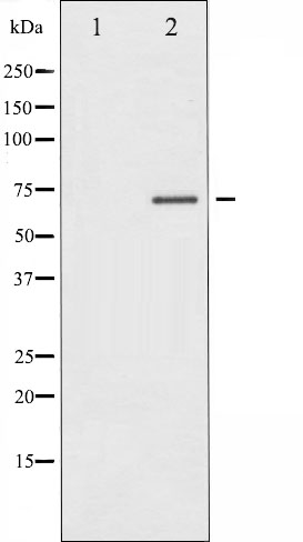 p-Estrogen receptor (S104) Ab