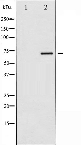 p-Estrogen receptor (S118) Ab