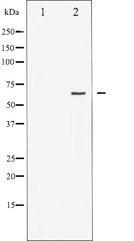 p-Estrogen receptor (S167) Ab