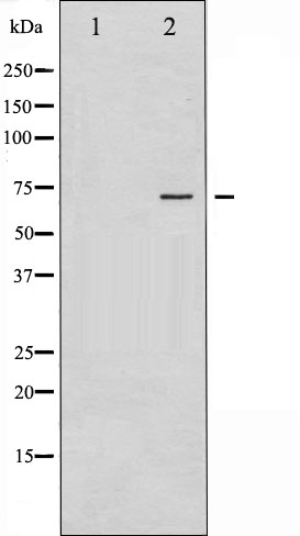 p-Estrogen receptor (Y537) Ab