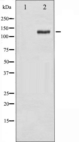 p-Focal adhesion kinase 1 (Y925) Ab