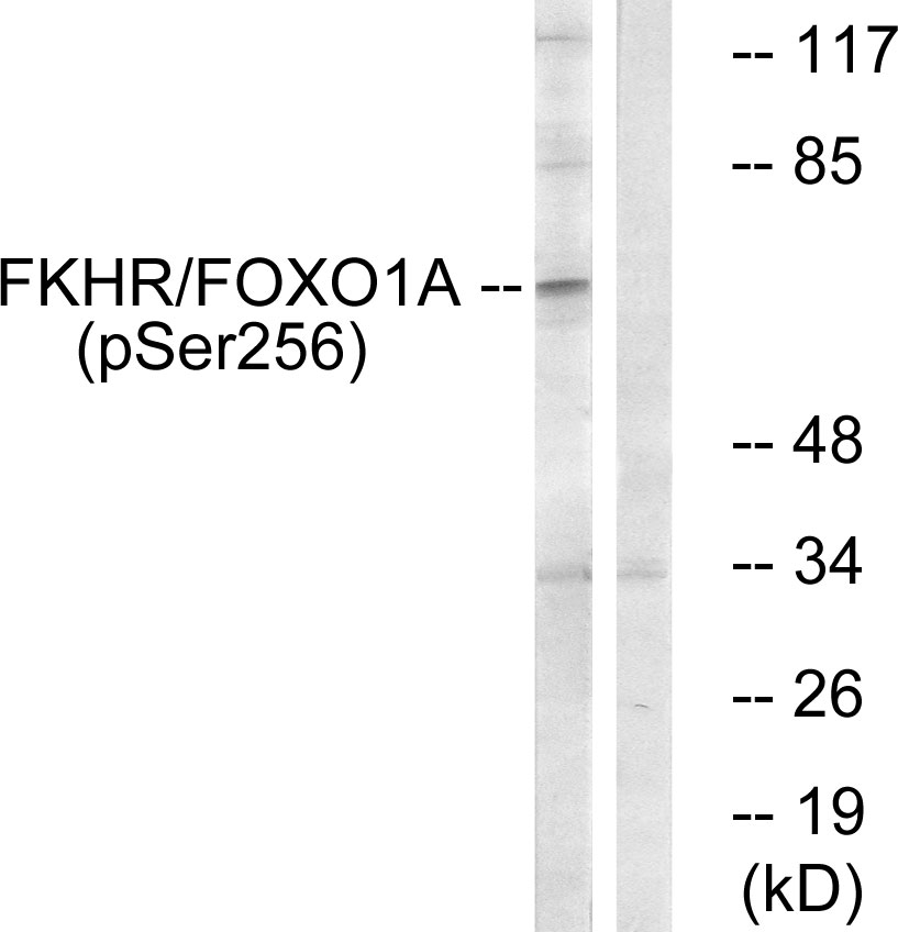 p-FOXO1 (S256) Ab