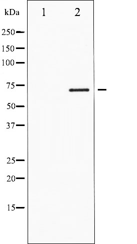 p-FOXO1 (S319) Ab