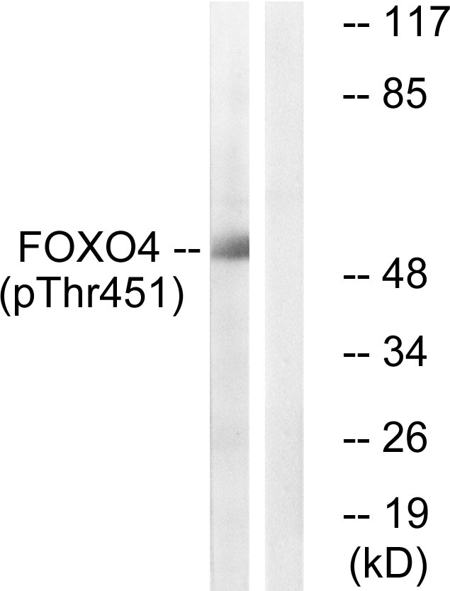 p-FOXO4 (T451) Ab