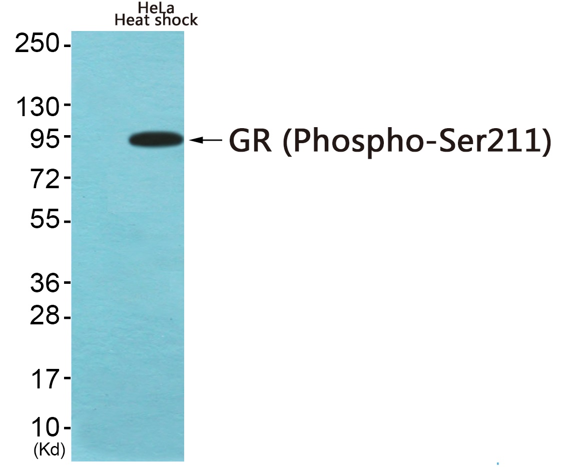 p-Glucocorticoid receptor (S211) Ab