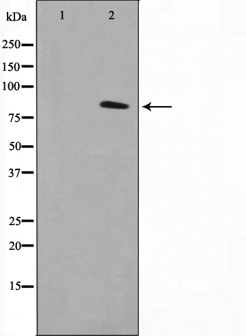 p-Glucocorticoid receptor (S226) Ab