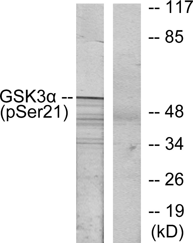 p-GSK3 alpha (S21) Ab