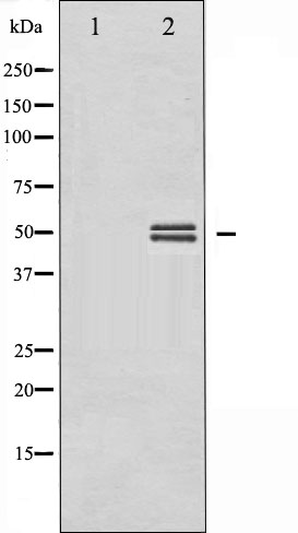 p-GSK3 alpha/beta (Y279/Y216) Ab