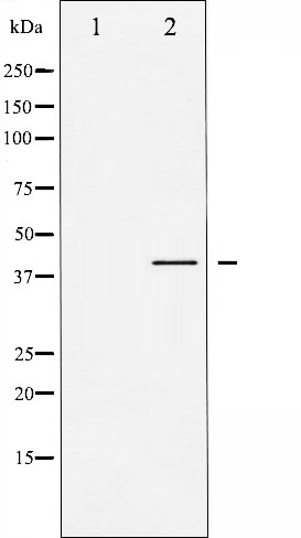 p-GSK3 beta (S9) Ab