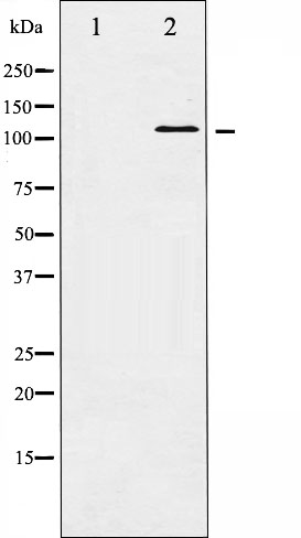 p-HDAC5 (S498) Ab