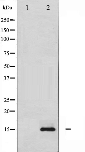 p-Histone H2A.X (S139) Ab