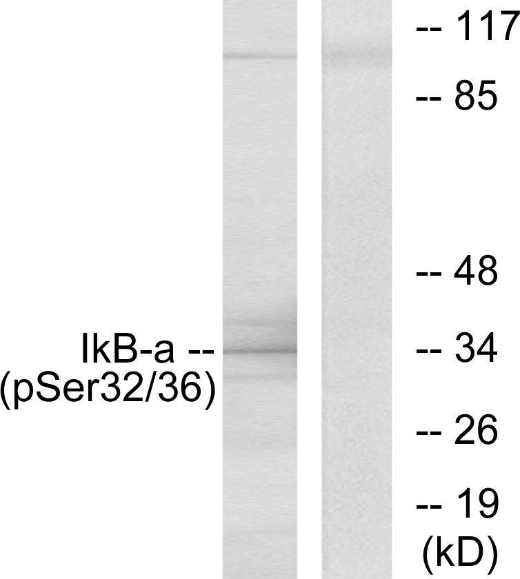 p-IkB alpha (S32/S36) Ab