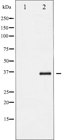 p-IkB beta (S23) Ab