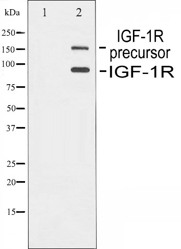 p-IGF1R (Y1165/Y1166) Ab