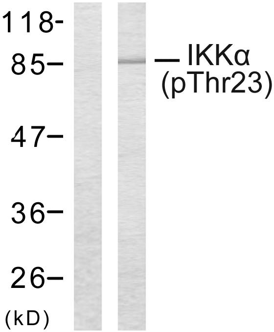 p-IKK alpha (T23) Ab