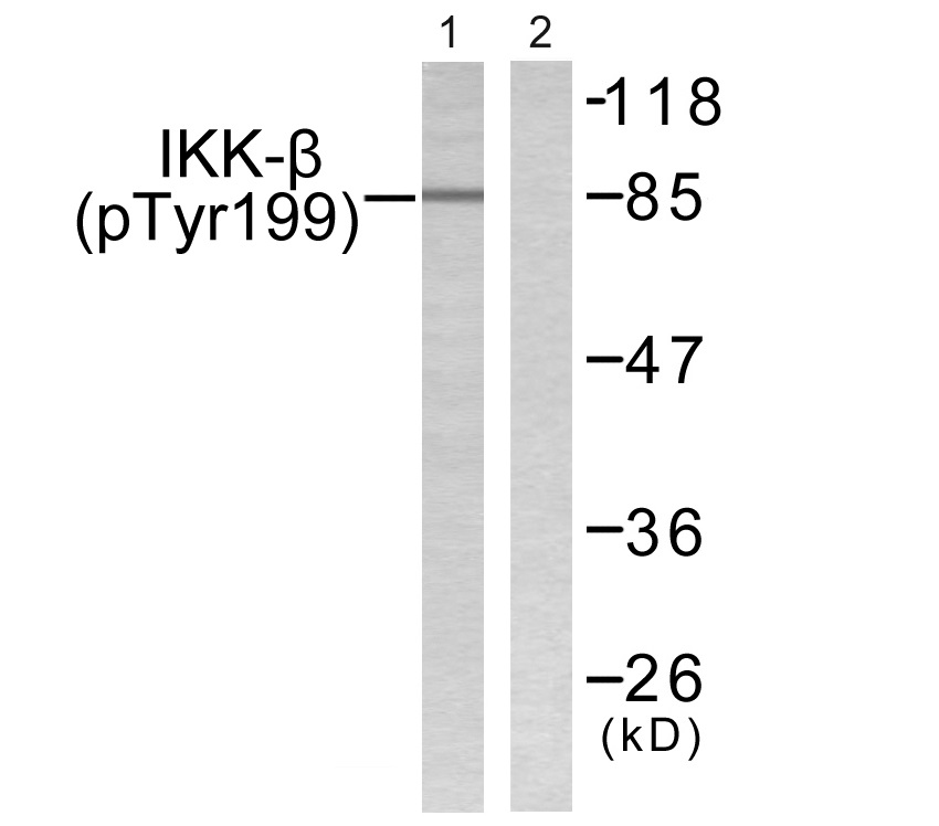 p-IKK beta (Y199) Ab