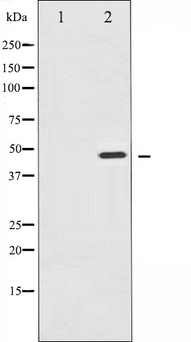 p-IKK gamma (S31) Ab