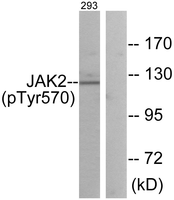 p-JAK2 (Y570) Ab