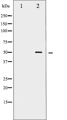 p-c Myc (S62) Ab