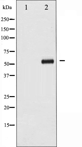 p-c Myc (T58) Ab