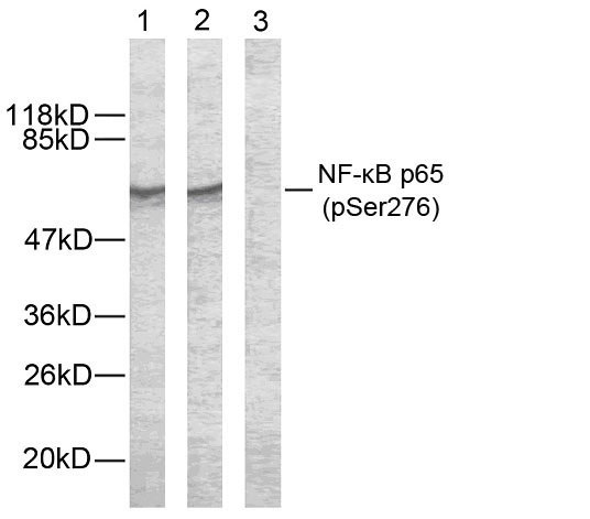 p-NF-kB p65 (S276) Ab