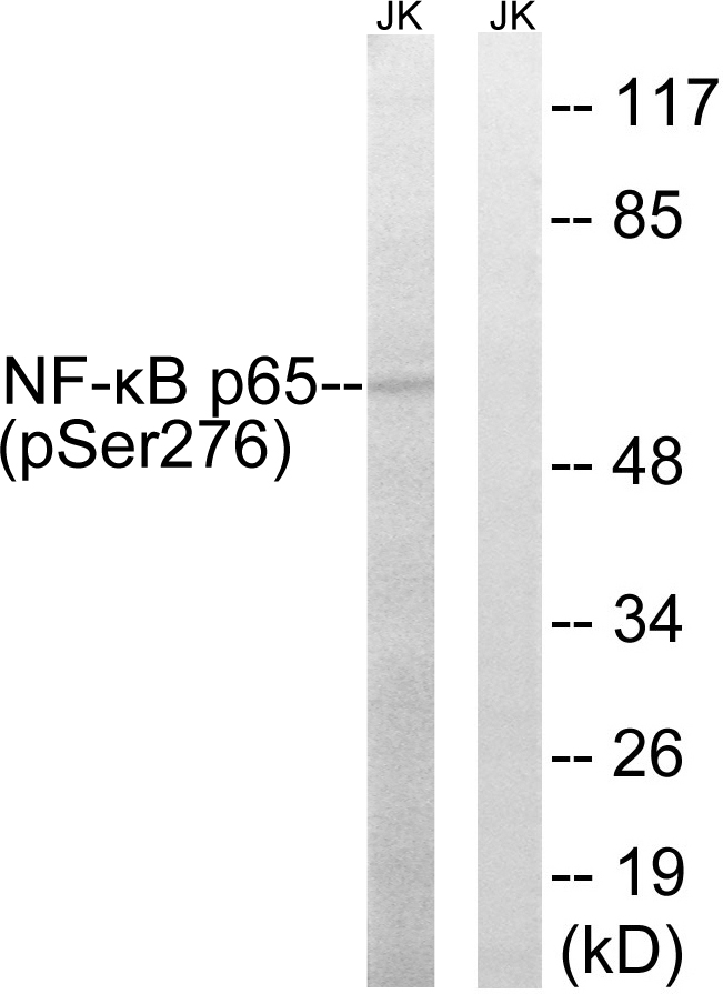 p-NF-kB p65 (S276) Ab