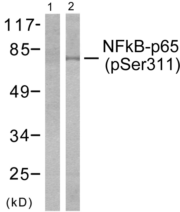 p-NF-kB p65 (S311) Ab