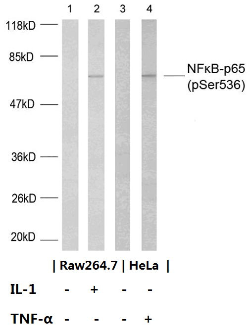 p-NF-kB p65 (S536) Ab