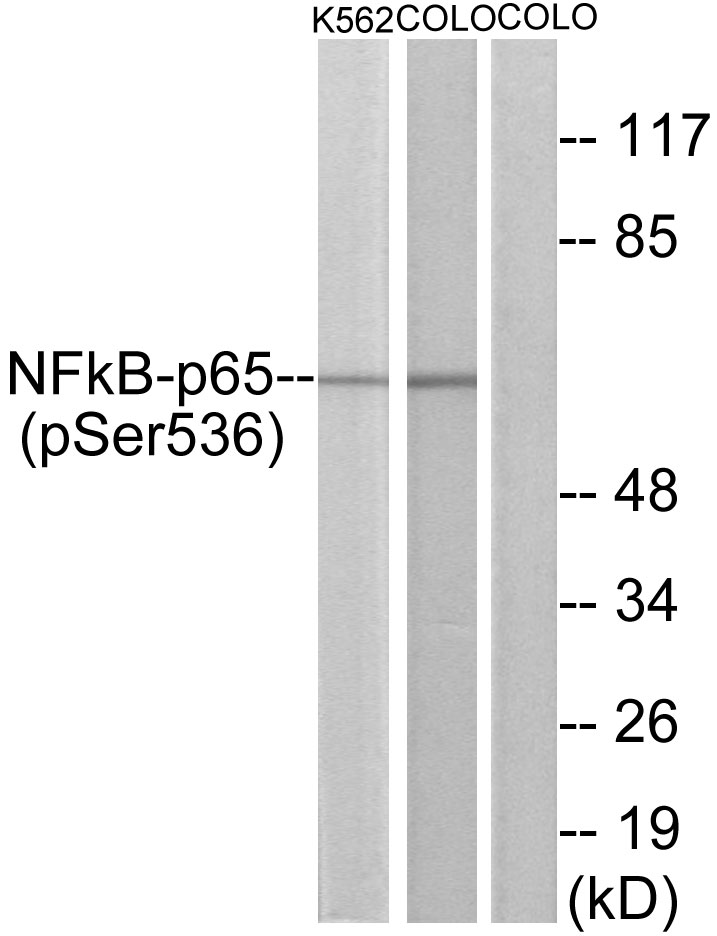 p-NF-kB p65 (S536) Ab