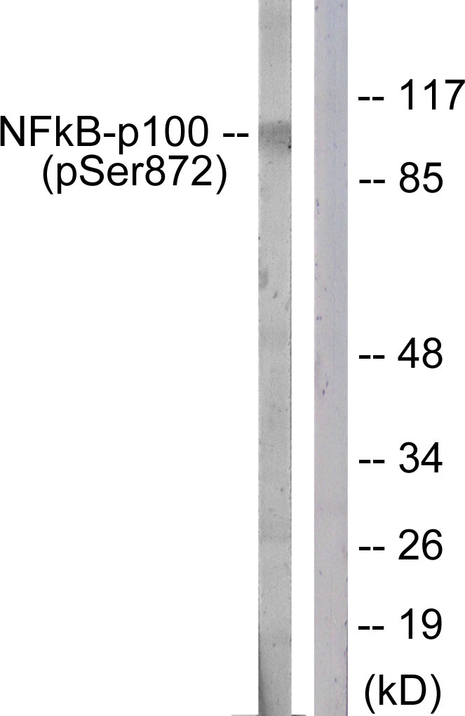 p-NF-kB p52 (S872) Ab