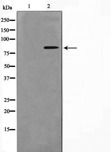 p-p95 NBS1 (S278) Ab