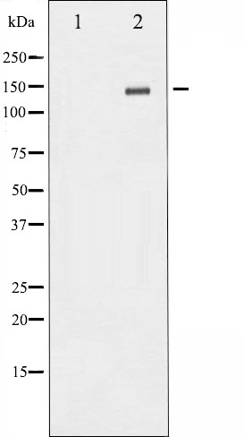 p-GluN2B (Y1336) Ab