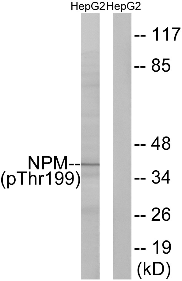 p-Nucleophosmin (T199) Ab