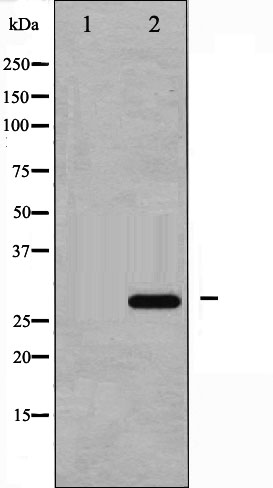 p-p27 Kip1 (T187) Ab