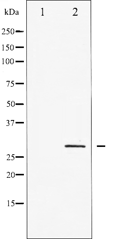 p-p27 Kip1 (T198) Ab