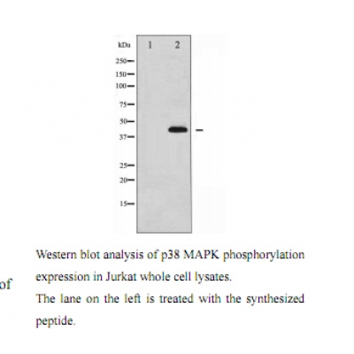 p-p38 MAPK (T180/T182) Ab
