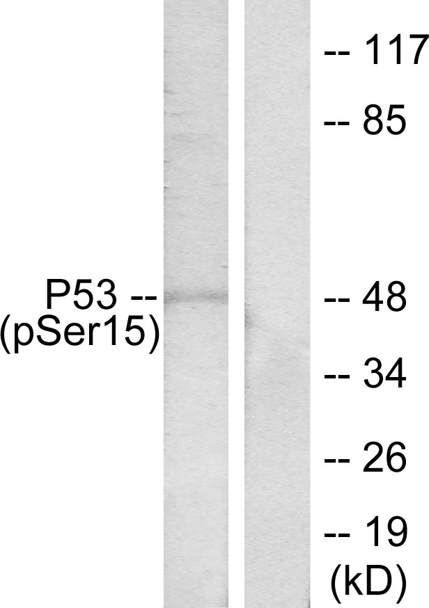 p-p53 (S15) Ab