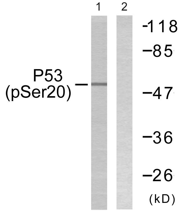 P-p53 (s20) Ab - 上海埃必威生物技术有限公司