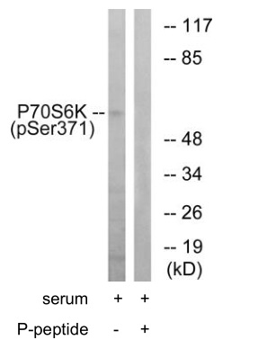 p-p70 S6 Kinase (S371) Ab