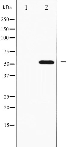 p-p70 S6 kinase beta 2 (S423) Ab