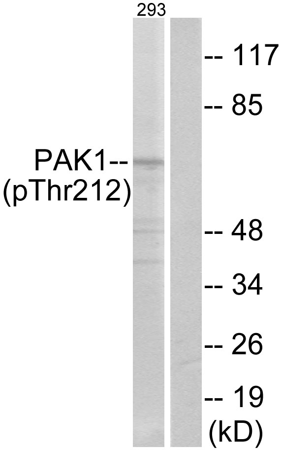 p-PAK1 (T212) Ab