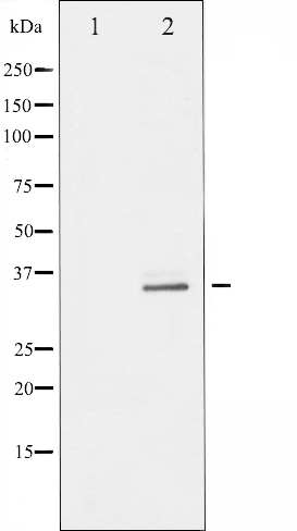 p-RPS6 (S235) Ab