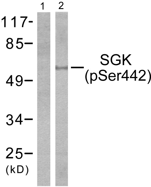 p-SGK1 (S422) Ab