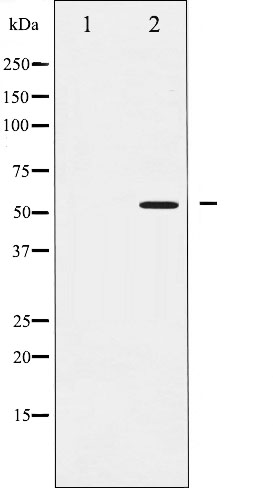 p-SMAD2 (S467) Ab